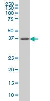 Anti-FCMR Mouse Monoclonal Antibody [clone: 1E4]