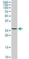 Anti-ICOS Rabbit Polyclonal Antibody