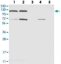 Anti-ACLY Rabbit Polyclonal Antibody