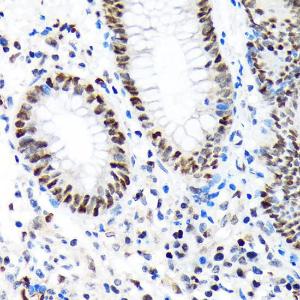 Immunohistochemistry analysis of paraffin-embedded human appendix tissue using Anti-Baf180 Antibody [ARC1820] (A309071) at a dilution of 1:100 (40X lens). Perform microwave antigen retrieval with 10 mM Tris/EDTA buffer pH 9.0 before commencing with IHC staining protocol