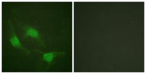 Anti-p53 Rabbit Polyclonal Antibody