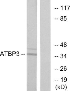 Western blot analysis of lysates from LOVO cells using Anti-ATPBD3 Antibody. The right hand lane represents a negative control, where the antibody is blocked by the immunising peptide