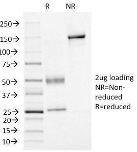 Anti-FOXA1 antibody