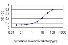 Anti-TDP1 Mouse Monoclonal Antibody [clone: 2A10-G2]