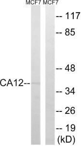 Western blot analysis of lysates from MCF-7 cells using Anti-CA12 Antibody. The right hand lane represents a negative control, where the antibody is blocked by the immunising peptide.