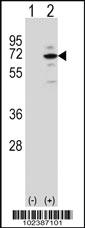 Anti-MECP2 Rabbit Polyclonal Antibody