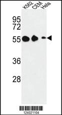 Anti-GALR1 Rabbit Polyclonal Antibody