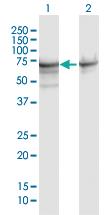 Anti-HSPA1A Rabbit Polyclonal Antibody