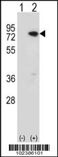 Anti-MECP2 Rabbit Polyclonal Antibody