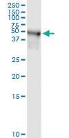 Anti-TRIP6 Rabbit Polyclonal Antibody