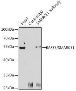 Immunoprecipitation analysis of 150 µg extracts of Jurkat cells using 3 µg of Anti-BAF57/SMARCE1 Antibody (A92974). This Western blot was performed on the immunoprecipitate using Anti-BAF57/SMARCE1 Antibody (A92974) at a dilution of 1:1000