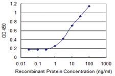 Anti-ARID5B Mouse Monoclonal Antibody [clone: 1C2]