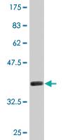 Anti-SLC12A1 Mouse Monoclonal Antibody [clone: 4H4]