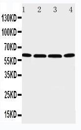 Anti-P2X6 Rabbit Polyclonal Antibody