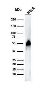 Anti-FOXA1 antibody