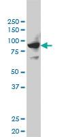 Anti-SH2D3C Mouse Monoclonal Antibody [clone: 3B2]