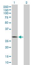 Anti-ICOS Rabbit Polyclonal Antibody