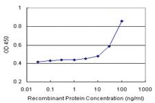 Anti-ALDH1A1 Antibody Pair