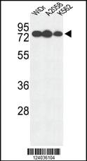 Anti-GUSB Rabbit Polyclonal Antibody