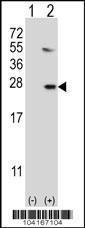 Anti-UBE2G1 Rabbit Polyclonal Antibody (PE (Phycoerythrin))