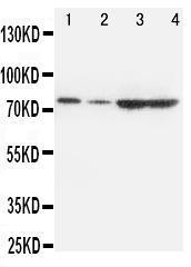 Anti-PCSK9 Rabbit Polyclonal Antibody