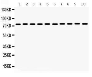 Anti-HSPA9 Rabbit Polyclonal Antibody