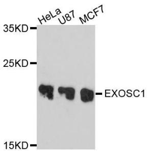 Western blot analysis of extracts of various cell lines, using Anti-EXOSC1 Antibody (A10302) at 1:1,000 dilution