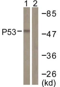 Anti-p53 Rabbit Polyclonal Antibody