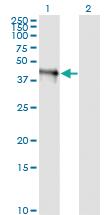 Anti-FCMR Mouse Monoclonal Antibody [clone: 1E4]