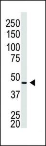 Anti-GJA5 Rabbit Polyclonal Antibody (FITC (Fluorescein))