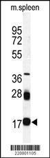 Anti-UBE2I Mouse Monoclonal Antibody [clone: 10i82]