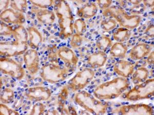 Anti-HSPA9 Rabbit Polyclonal Antibody