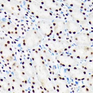 Immunohistochemistry analysis of paraffin-embedded mouse kidney using Anti-Baf180 Antibody [ARC1820] (A309071) at a dilution of 1:100 (40X lens). Perform microwave antigen retrieval with 10 mM Tris/EDTA buffer pH 9.0 before commencing with IHC staining protocol