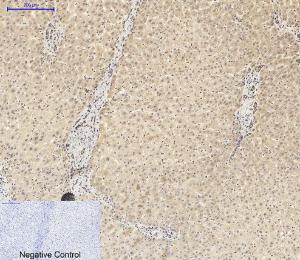 Immunohistochemical analysis of paraffin-embedded human liver tissue using Anti-ASC Antibody at 1:200 (4°C overnight). Negative control was secondary antibody only