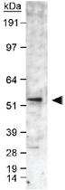 Anti-CYP19A1 Rabbit Polyclonal Antibody