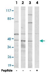 Anti-HORMAD1 Rabbit Polyclonal Antibody