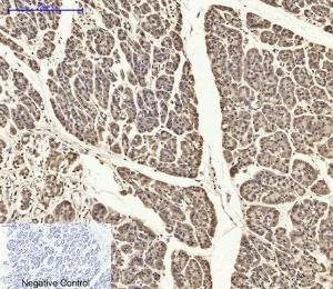 Immunohistochemical analysis of paraffin-embedded human stomach cancer tissue using Anti-ASC Antibody at 1:200 (4°C overnight). Negative control was secondary antibody only