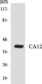 Anti-CA12 Rabbit Polyclonal Antibody