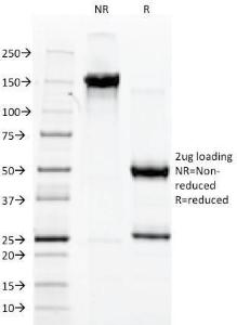 SDS-PAGE analysis of Anti-Von Willebrand Factor Antibody [3E2D10] under non-reduced and reduced conditions; showing intact IgG and intact heavy and light chains, respectively. SDS-PAGE analysis confirms the integrity and purity of the antibody.