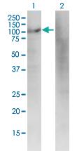 Anti-DIAPH3 Mouse Monoclonal Antibody [clone: 4D5]