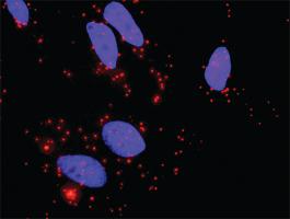 Anti-TGFB2 + BMP2 Antibody Pair