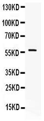 Anti-IKZF1 Rabbit Polyclonal Antibody