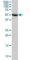 Anti-UGP2 Mouse Monoclonal Antibody [clone: 3H3]