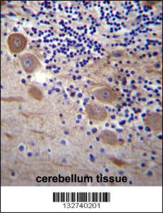 Anti-SSR2 Rabbit Polyclonal Antibody (FITC (Fluorescein Isothiocyanate))