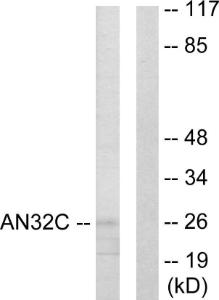 Western blot analysis of lysates from HUVEC cells using Anti-ANP32C Antibody. The right hand lane represents a negative control, where the antibody is blocked by the immunising peptide