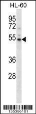 Anti-CAMKV Rabbit Polyclonal Antibody (APC (Allophycocyanin))