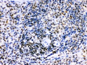 Anti-IKZF1 Rabbit Polyclonal Antibody