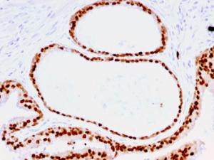 Immunohistochemical analysis of formalin-fixed, paraffin-embedded human prostate using Anti-FOXA1 Antibody [FOXA1/1516]