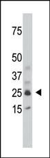 Anti-SULT1C2 Rabbit Polyclonal Antibody