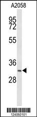 Anti-HSD17B12 Rabbit Polyclonal Antibody